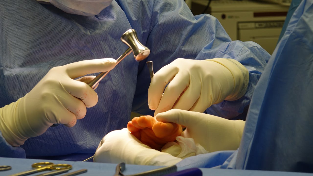 Contact Detailed image of a surgical team performing a foot procedure in a sterile environment.