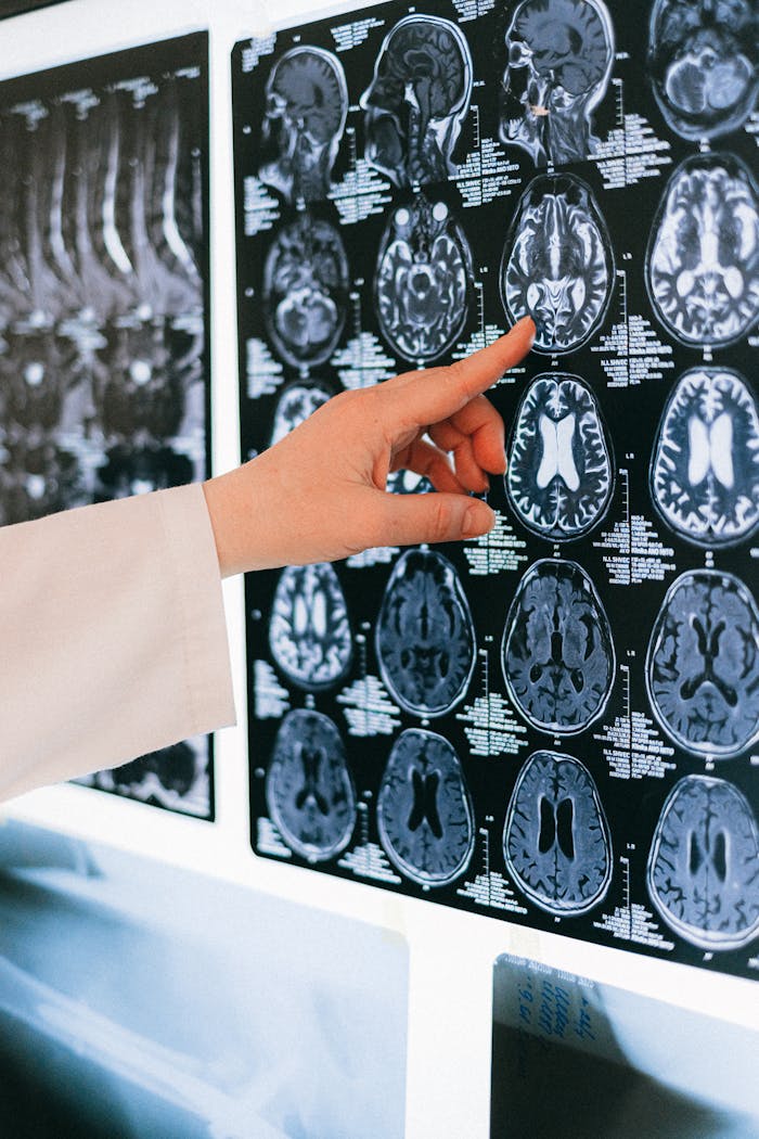 Services A doctor's hand points to a brain MRI scan on a lightbox, illustrating medical diagnosis.